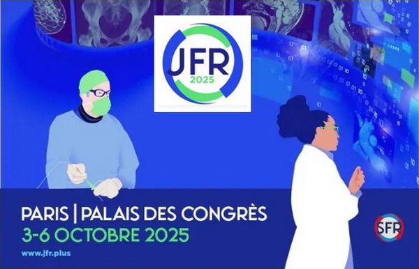 Impressions après avoir visité le salon JFR 2025